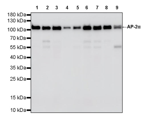 AP-2α Recombinant Rabbit mAb (S-4444-44)