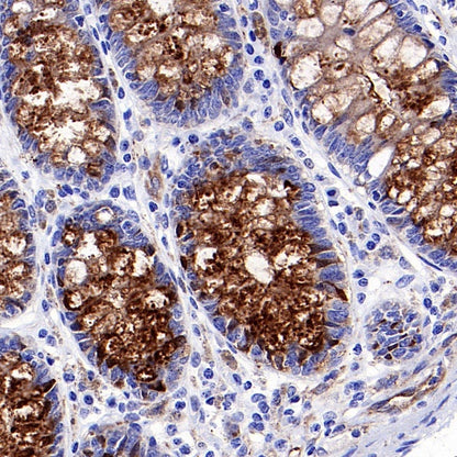 IGFBP2 Recombinant Rabbit mAb (S-808-24)