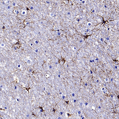 GFAP Recombinant Mouse mAb (SDT-3032)