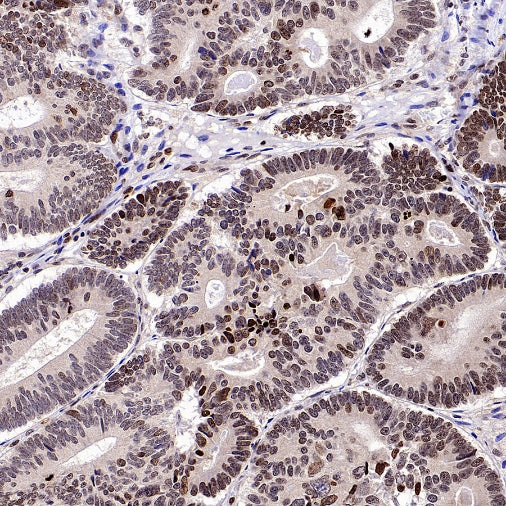 FOXM1 Recombinant Rabbit mAb (S-2529-26)