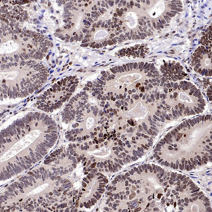 FOXM1 Recombinant Rabbit mAb (S-2529-26)