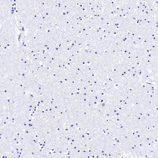 Langerin Recombinant Rabbit mAb (SDT-450-47)