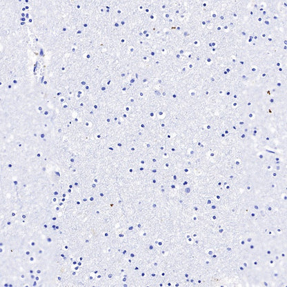 Langerin Recombinant Rabbit mAb (SDT-450-47)