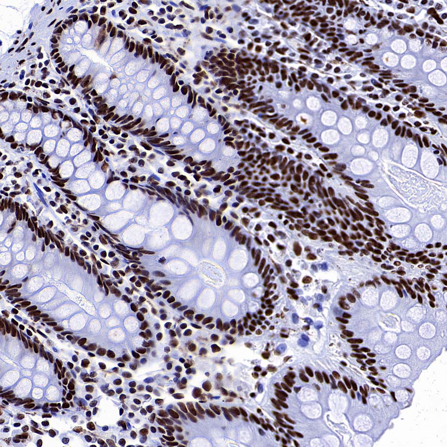 SMC1 Recombinant Rabbit mAb (S-4147-54)