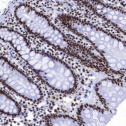 SMC1 Recombinant Rabbit mAb (S-4147-54)
