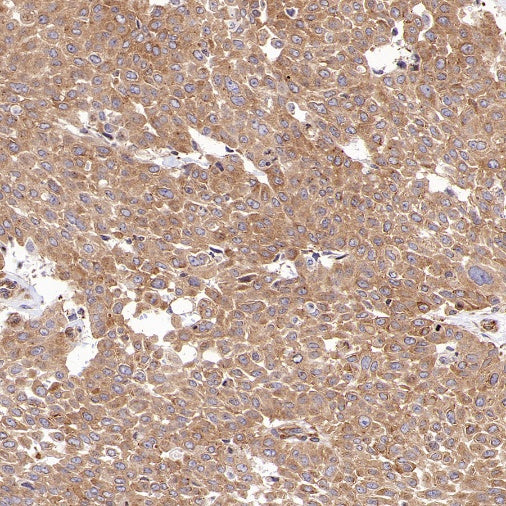 G3BP1 Rabbit Polyclonal Antibody