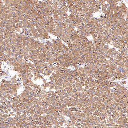 G3BP1 Rabbit Polyclonal Antibody
