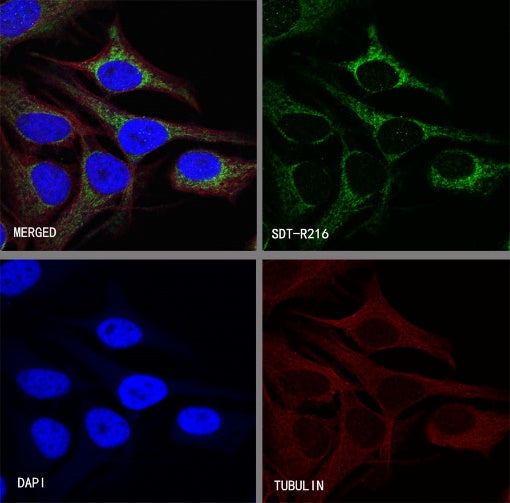 Alpha B Crystallin Recombinant Rabbit mAb (S-R216)