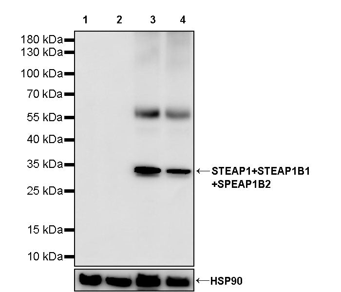 STEAP1+STEAP1B1+STEAP1B2 Recombinant Rabbit mAb (S-3226-137)