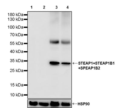 STEAP1+STEAP1B1+STEAP1B2 Recombinant Rabbit mAb (S-3226-137)