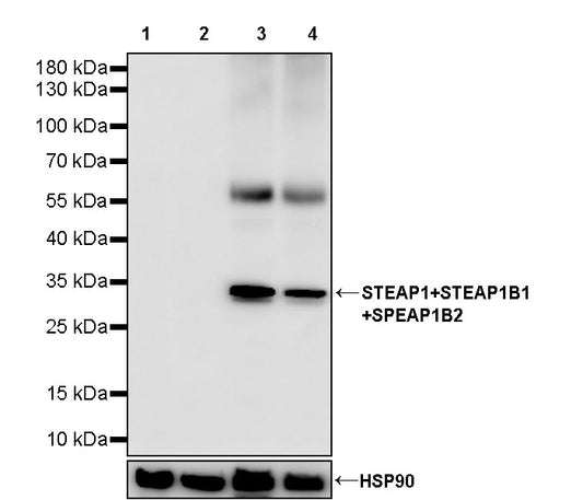STEAP1+STEAP1B1+STEAP1B2 Recombinant Rabbit mAb (S-3226-137)