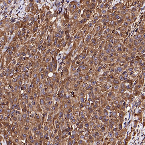 Calnexin Rabbit Polyclonal Antibody