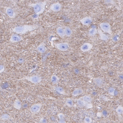 PKC alpha Recombinant Rabbit mAb (S-624-36)