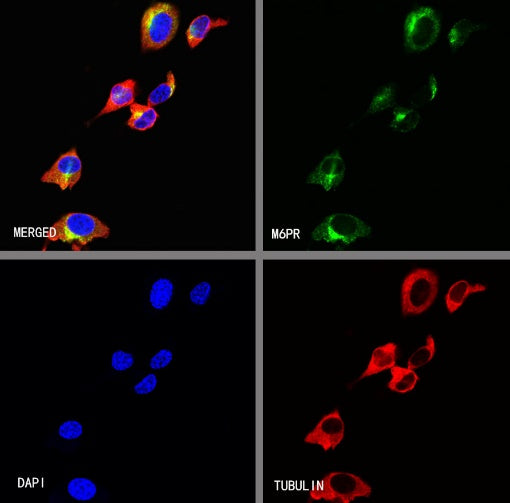 M6PR Recombinant Rabbit mAb (S-1480-21)