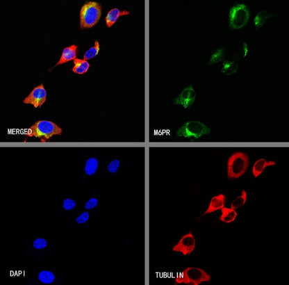 M6PR Recombinant Rabbit mAb (S-1480-21)