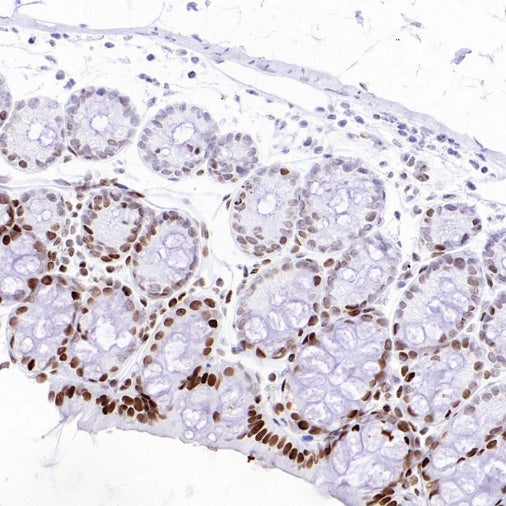 Histone H3 (acetyl K23) Recombinant Rabbit mAb (S-3321-202)