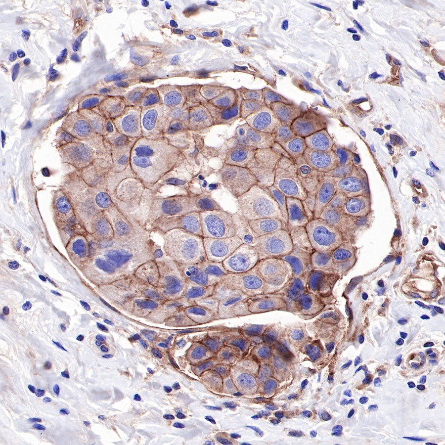 CD155/PVR Recombinant Rabbit mAb (SDT-289-68)