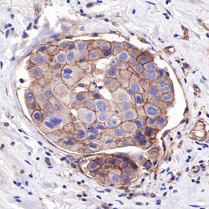CD155/PVR Recombinant Rabbit mAb (SDT-289-68)