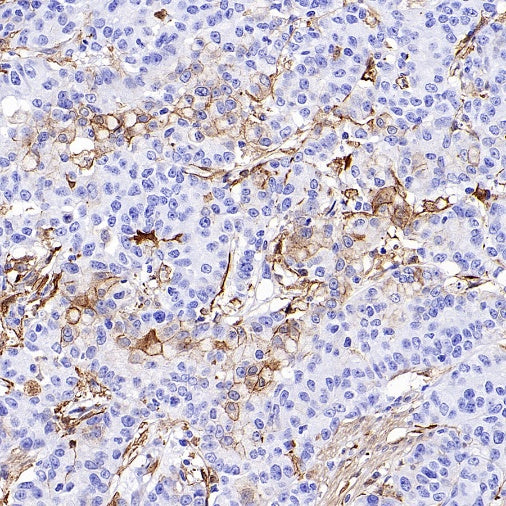 FAP Recombinant Rabbit mAb (S-3094-29)