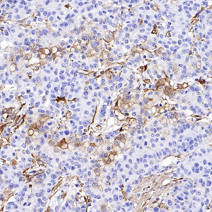 FAP Recombinant Rabbit mAb (S-3094-29)
