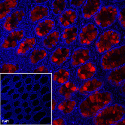 Reg4 Recombinant Rabbit mAb (SDT-1232-23)