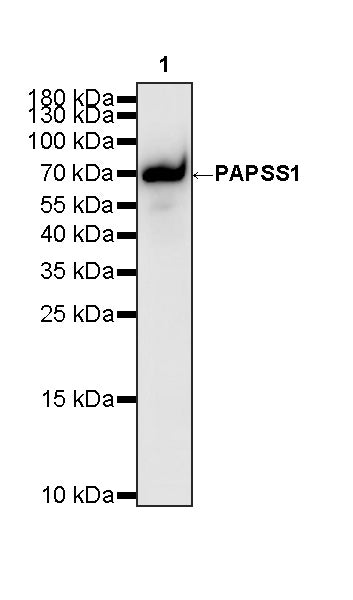 PAPSS1 Recombinant Rabbit mAb (S-3516-23)