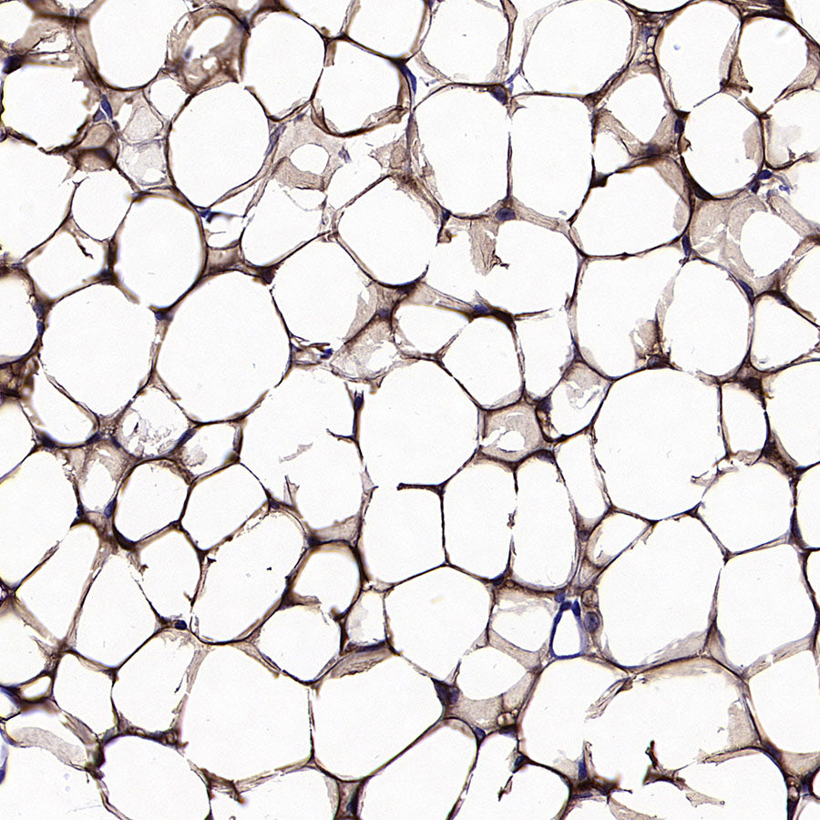 PNPLA2 Recombinant Rabbit mAb (S-5409)