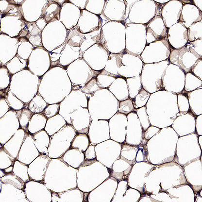 PNPLA2 Recombinant Rabbit mAb (S-5409)