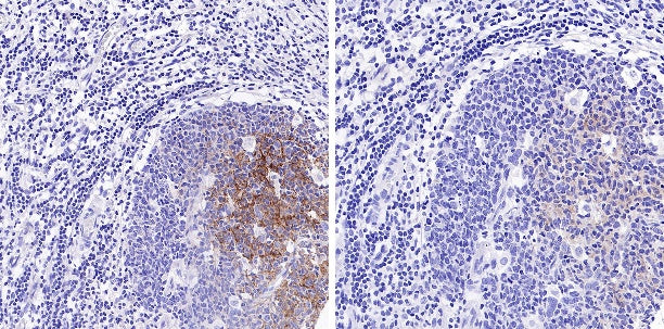 Phospho- Zap-70 (Tyr319)/Syk (Tyr352) Recombinant Rabbit mAb (S-1252-12)