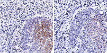 Phospho- Zap-70 (Tyr319)/Syk (Tyr352) Recombinant Rabbit mAb (S-1252-12)