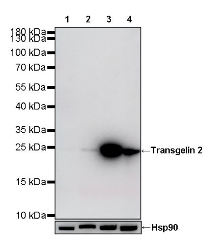 Transgelin 2 Recombinant Rabbit mAb (S-2809-73)
