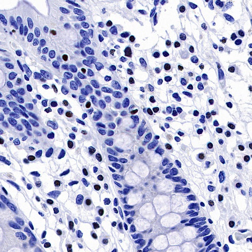 AiolosI/KZF3 Recombinant Rabbit mAb (S-1268-42)
