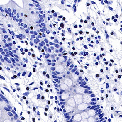 AiolosI/KZF3 Recombinant Rabbit mAb (S-1268-42)