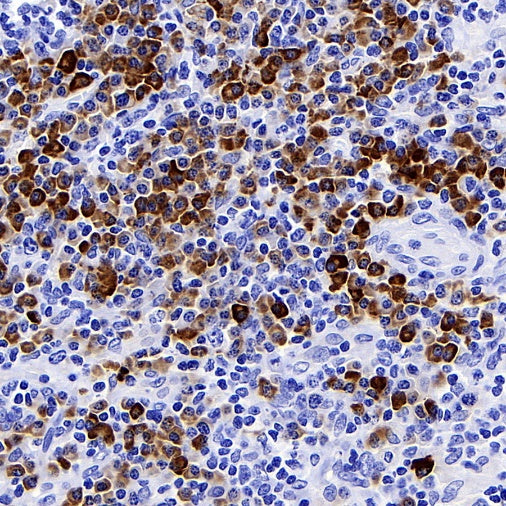 CXCR3 Recombinant Rabbit mAb (S-377-8)
