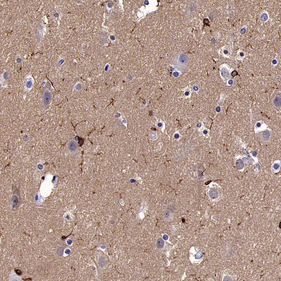 FOXO4 Recombinant Rabbit mAb (S-3527-19)