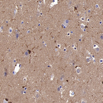 FOXO4 Recombinant Rabbit mAb (S-3527-19)
