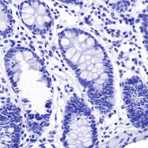 Arginase-1 Recombinant Rabbit mAb (SDT-369-33)