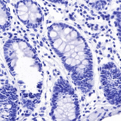 Arginase-1 Recombinant Rabbit mAb (SDT-369-33)