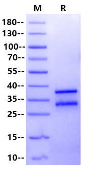 Biotinylated CD8 alpha&beta (CD8A&CD8B) Heterodimer,His,Avi Tag&Tag Free Protein, Human