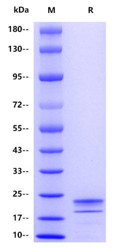 Human IL-1beta, His tag