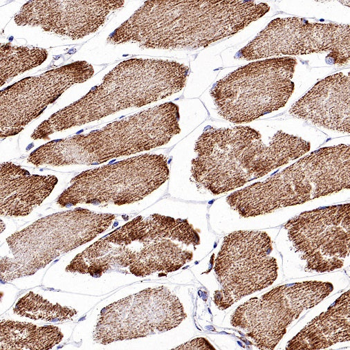 HADHA Recombinant Rabbit mAb (S-2345-8)