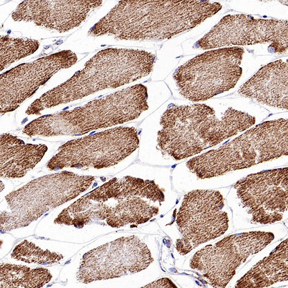 HADHA Recombinant Rabbit mAb (S-2345-8)