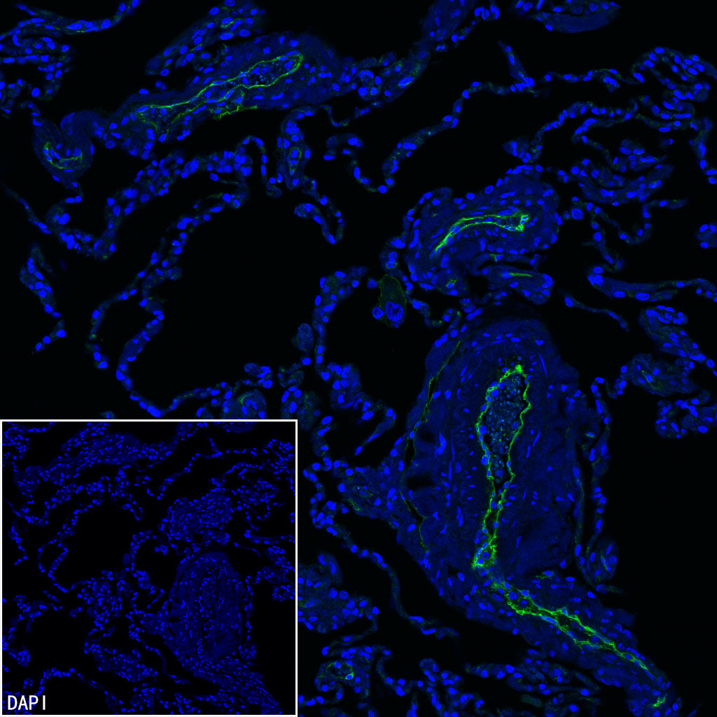 EPCR/PROCR (CD201) Rabbit Polyclonal Antibody