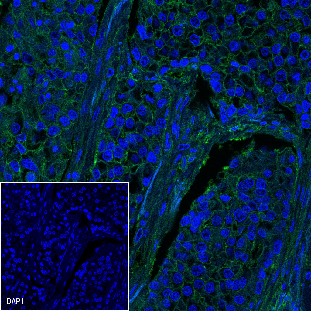 B7-H3 Recombinant Rabbit mAb,PBS Only (SDT-249-26)