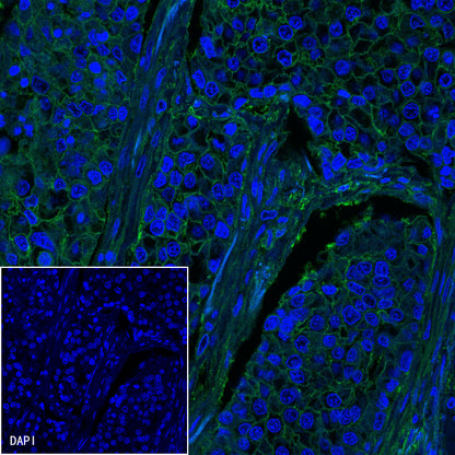 B7-H3 Recombinant Rabbit mAb,PBS Only (SDT-249-26)