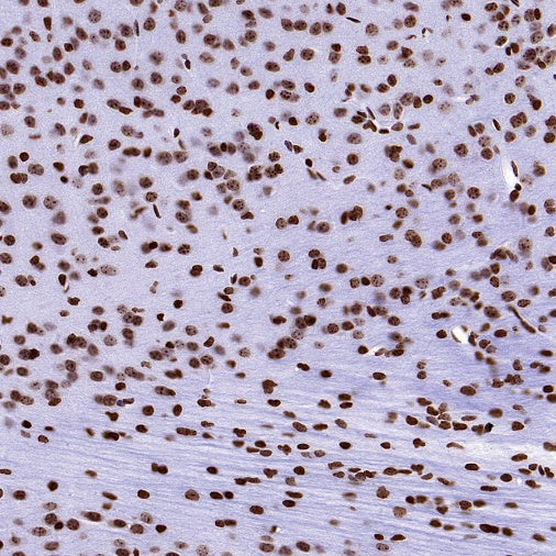 Histone H3 (mono methyl K36) Recombinant Rabbit mAb (S-859-505)
