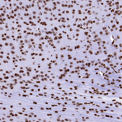 Histone H3 (mono methyl K36) Recombinant Rabbit mAb (S-859-505)