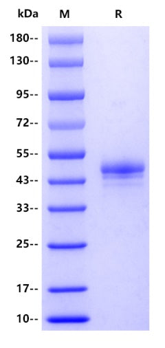SHBG His Tag Protein, Human
