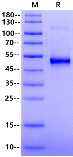 NFKB1 Protein, Human