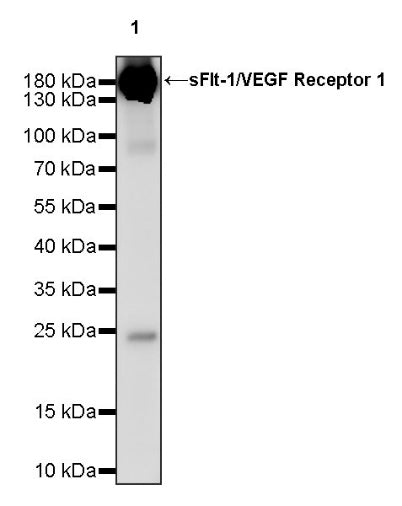 sFlt-1/VEGF Receptor 1 Recombinant Rabbit mAb (S-807-137)